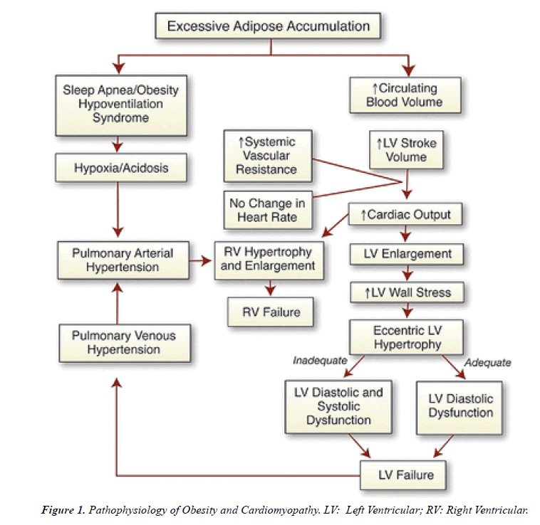 annals-cardiovascular-thoracic-surgery-Obesity