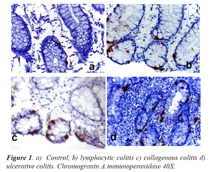 archives-digestive-disorders-immunoperoxidase