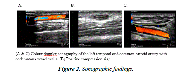 archives-general-internal-medicine-Sonographic-findings