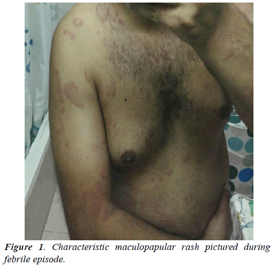 archives-of-general-internal-medicine-maculopapular-rash