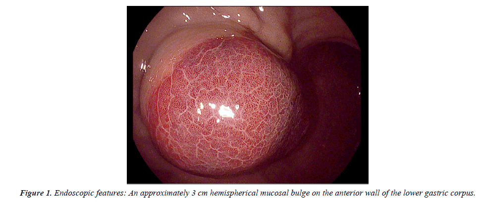 biology-medicine-case-report-Endoscopic-features