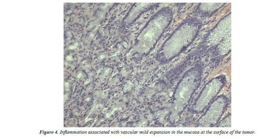 biology-medicine-case-report-Inflammation-associated