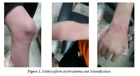 biology-medicine-case-report-erythroderma