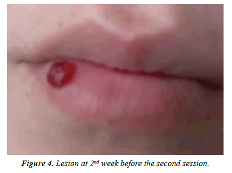 biology-medicine-case-report-lesion