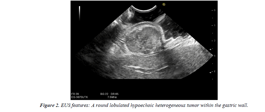 biology-medicine-case-report-lobulated-hypoechoic