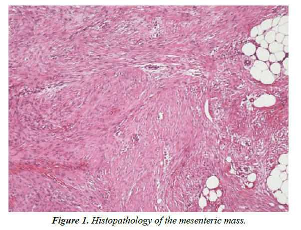 biology-medicine-case-report-mesenteric-mass