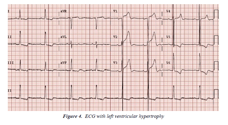 biology-medicine-case-report-ventricular-hypertrophy