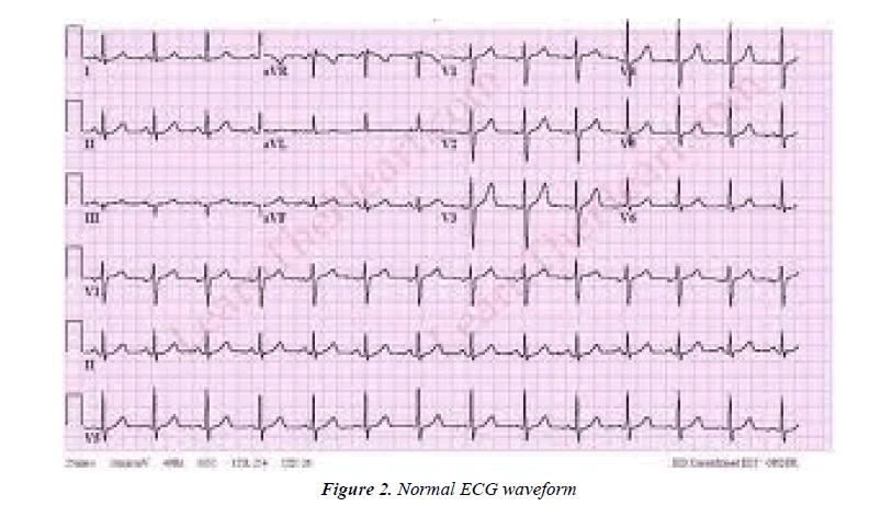 biology-medicine-case-report-waveform