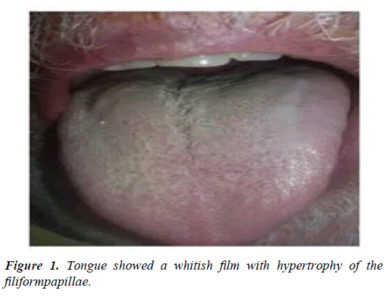 biology-medicine-case-report-whitish-film