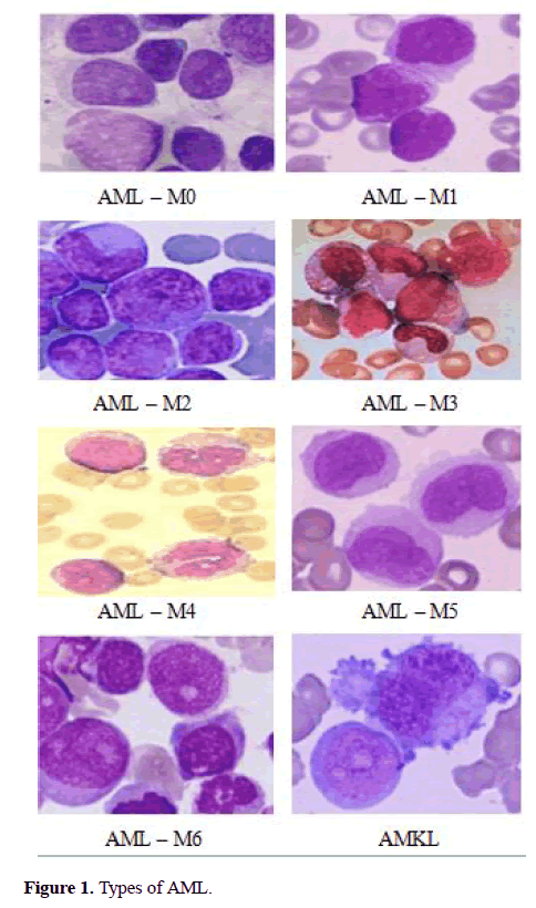 biomedical-imaging-bioengineering-AML