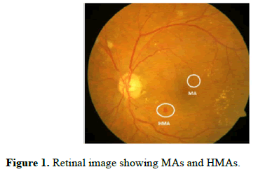 biomedical-imaging-bioengineering-Retinal-image