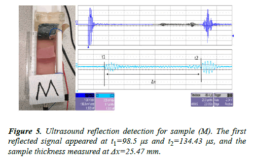 biomedical-imaging-bioengineering-detection