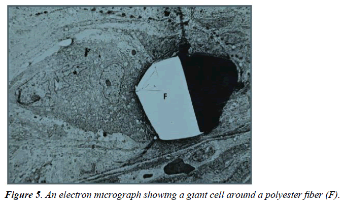 biomedical-imaging-bioengineering-giant-cell