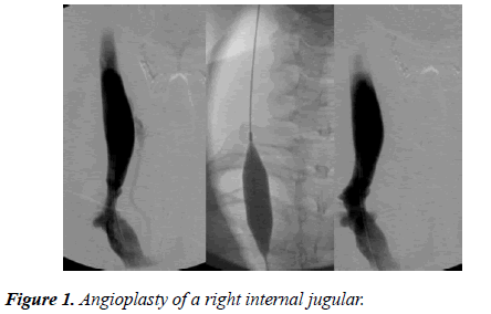 biomedical-imaging-bioengineering-internal-jugular