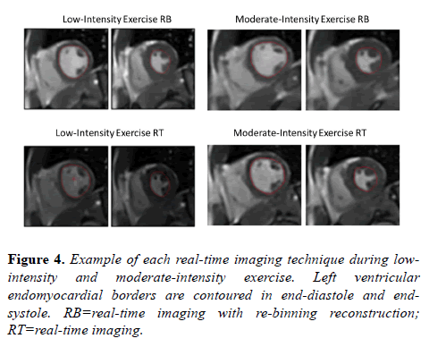 biomedical-imaging-bioengineering-moderate-intensity