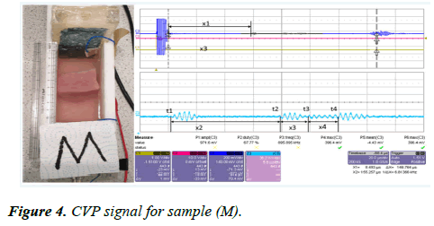 biomedical-imaging-bioengineering-signal