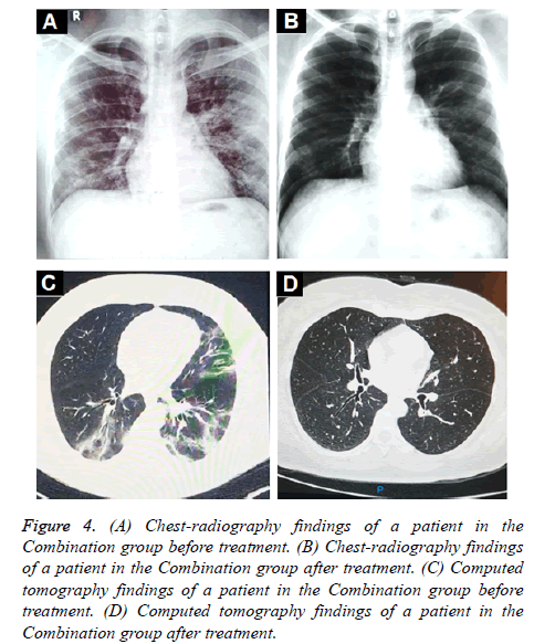 biomedres-Chest