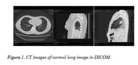 biomedres-lung