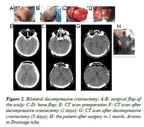 brain-neurology-patient-surgery