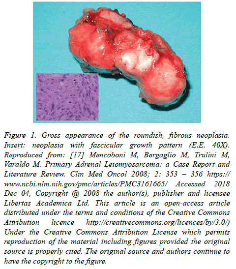 cancer-immunology-Gross-appearance