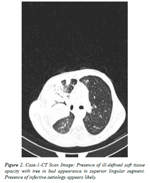 cancer-immunology-Scan-Image