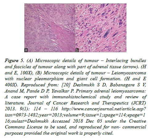 cancer-immunology-adrenal-tissue