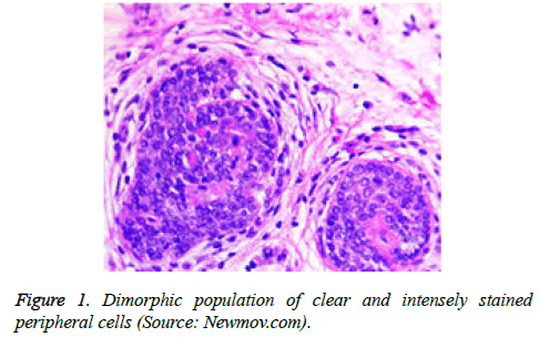 cancer-immunology-therapy-intensely-stained