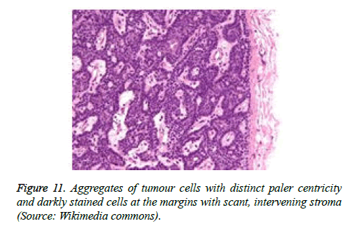 cancer-immunology-therapy-paler-centricity