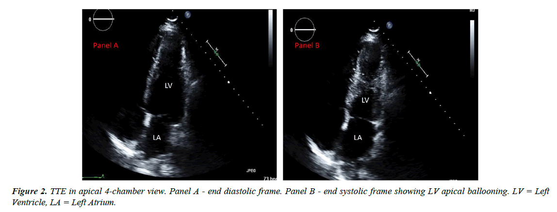 cardiovascular-medicine-chamber-view