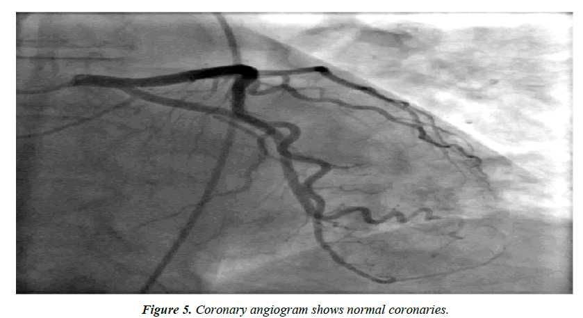 cardiovascular-medicine-normal-coronaries