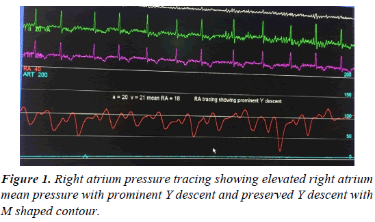 cardiovascular-medicine-pressure-prominent