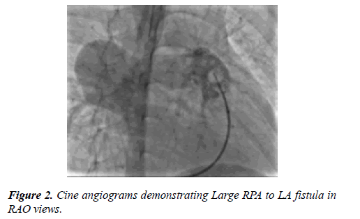 cardiovascular-medicine-therapeutics-angiograms