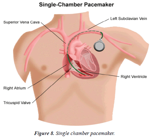 cardiovascular-medicine-therapeutics-chamber