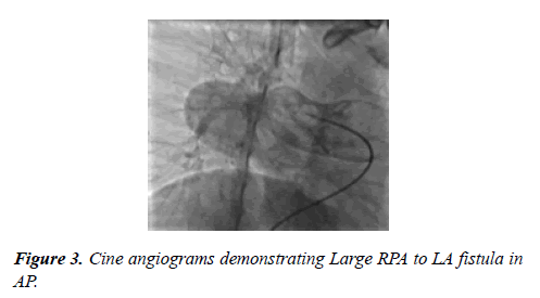 cardiovascular-medicine-therapeutics-cine-angiograms