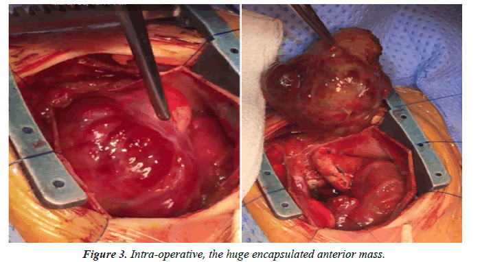 cardiovascular-medicine-therapeutics-encapsulated