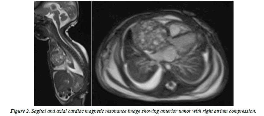 cardiovascular-medicine-therapeutics-magnetic