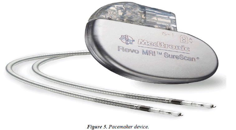 cardiovascular-medicine-therapeutics-pacemaker