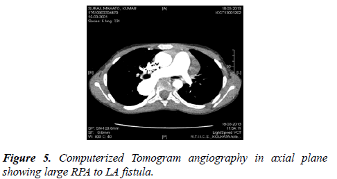 cardiovascular-medicine-therapeutics-tomogram