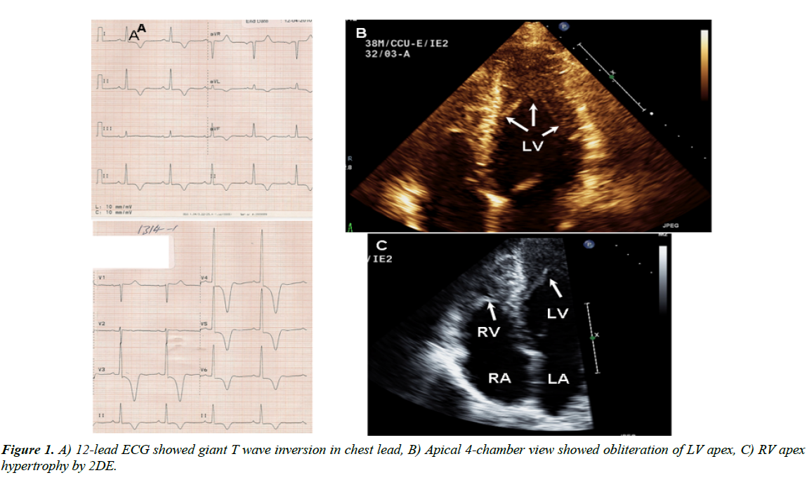 cardiovascular-medicine-wave-inversion