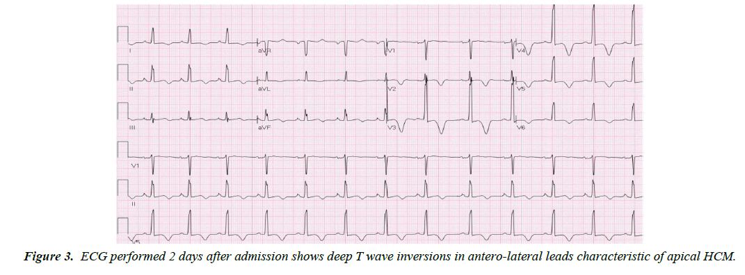 cardiovascular-medicine-wave-inversions