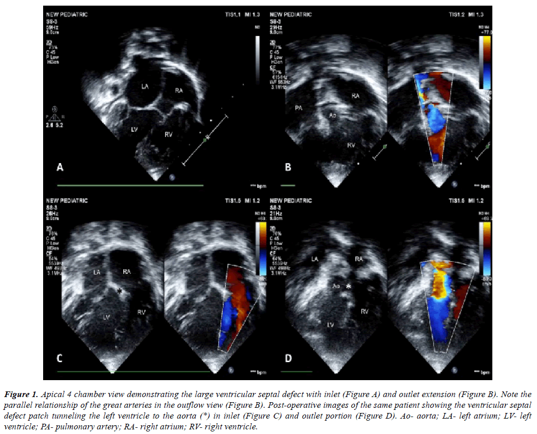 cardiovascular-thoracic-surgery-outlet-portion