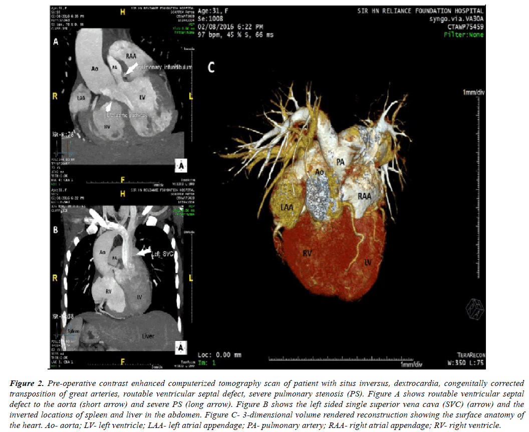 cardiovascular-thoracic-surgery-tomography-scan