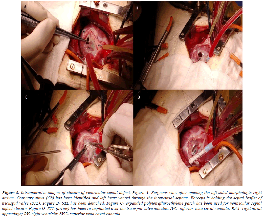 cardiovascular-thoracic-surgery-tomography-scan