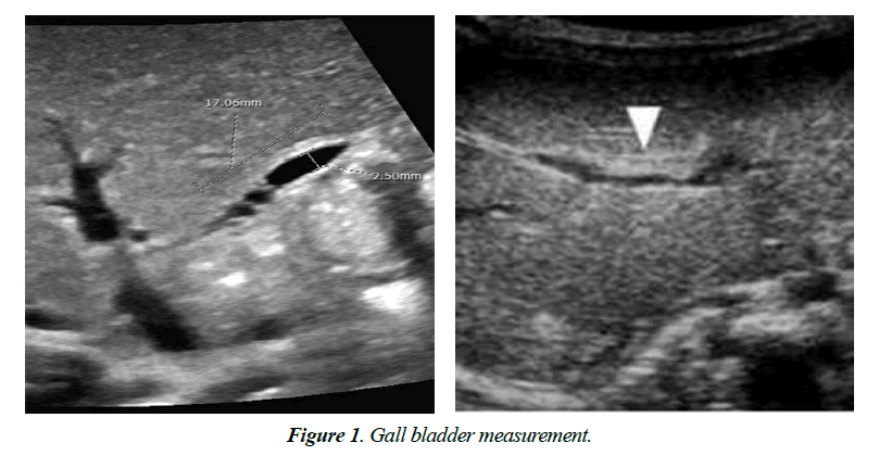 child-adolescent-health-Gall-bladder