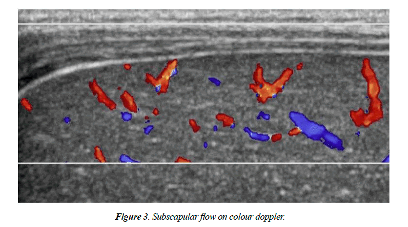 child-adolescent-health-colour-doppler