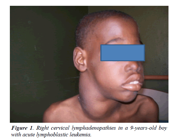 child-adolescent-health-lymphadenopathies