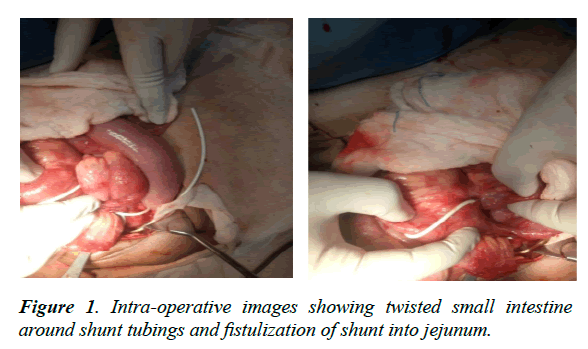 child-adolescent-health-small-intestine