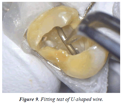 clinical-dentistry-Fitting-test