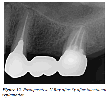 clinical-dentistry-Postoperative