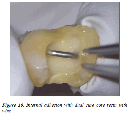 clinical-dentistry-dual-cure-core